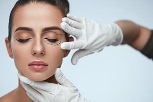 Patient Being Prepped for Blepharoplasty Surgery