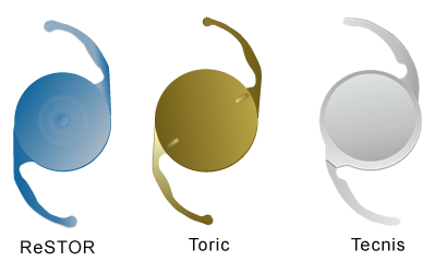 Intraocular Lens Examples